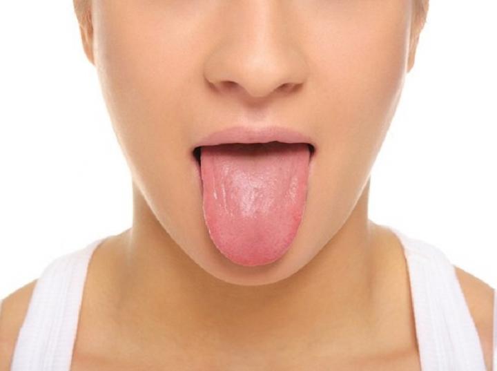 Padecimientos comunes de la lengua y cómo tratarlos