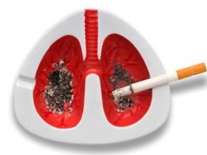 Conoce los factores de riesgo de padecer cáncer de pulmón