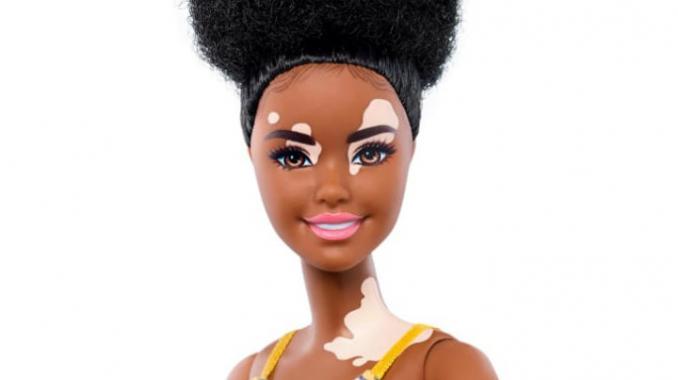 Barbie lanza muñecas con vitiligo para fortalecer la diversidad. Noticias en tiempo real